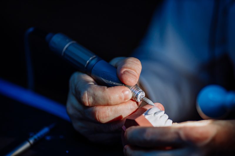 A dental technician processes a cast from the jaw of the patient