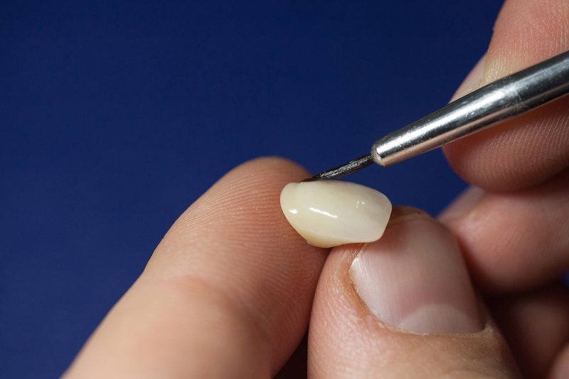 Dental technician working on a tooth denture